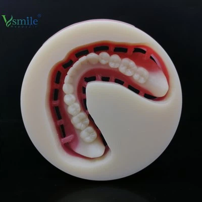 Totalprothese PMMA BLOCK